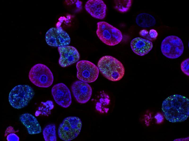Sürdürülebilirlik Raporlaması ve ESG - GRI Standartları ve Kurumsal Sorumluluk Eğitimi - Çevre Yönetimi